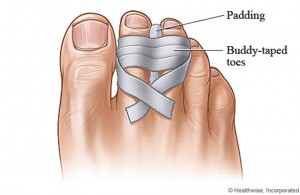 how to buddy tape a toe from online source